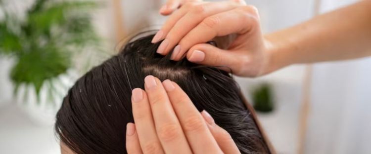 Cara Atasi Kulit Kepala Berminyak Tapi Rambut Kering